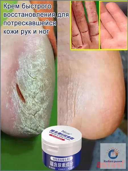 Крем Мазь от трещин для сухой кожи ног и рук, заживление, ,восстанавливающий и увлажняющий для грубой рук
