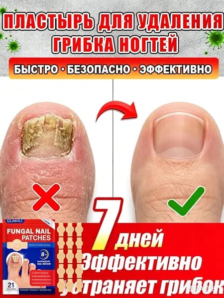 Пластыри от грибка ногтей быстро избавляют от грибковых инфекций рук и ног,а также вылечить утолщение ногтей, покраснение, отек, зуд, расслоение 21шт