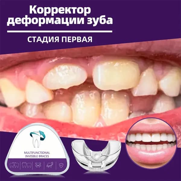 Мягкая трейнеров для зубов,Стоматологическая каппа-трейнер, Фаза 1,Для выравнивания зубов и исправления прикуса