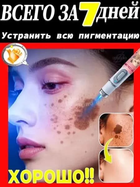 Лазер от веснушек, используемый для удаления веснушек, меланодермии, пигментных пятен, солнечных ожогов, красоты лица, безболезненный и без побочных эффектов