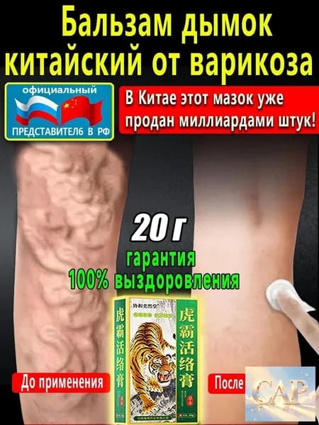 чудо бальзам дымок китайский от варикоза для восстановления варикозных вен от усталости и тяжести в ногах, Улучшают кровообращение в ногах.