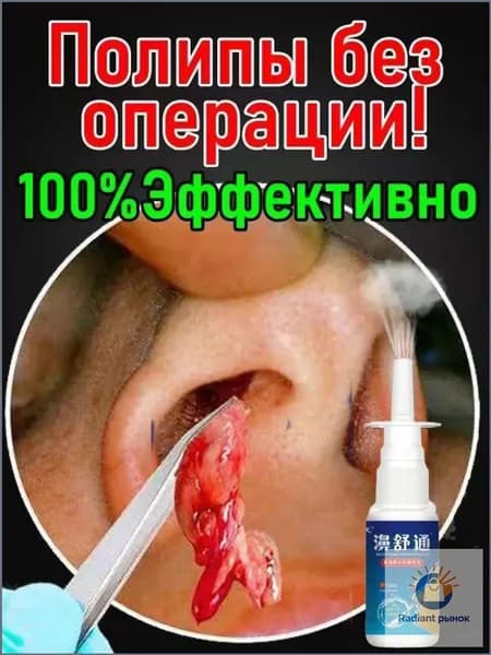 Спрей от полипов в носу без операции, 20 мл