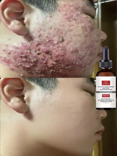 Эссенция для ухода за кожей, 5 мл