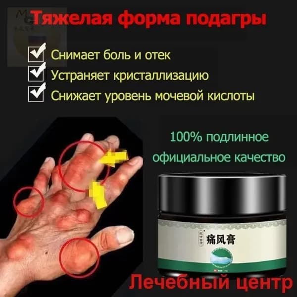 Мазь для суставов обезболивающая, Бальзам от подагры, артрита, ревматизм, мышечных суставов и пальцев