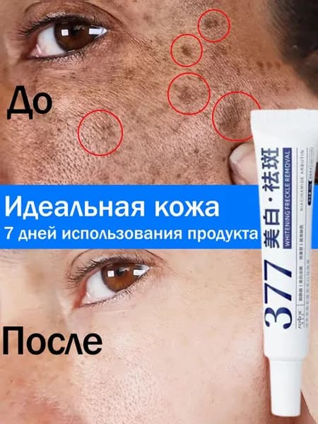 377 Отбеливающий крем для отбеливающего от пигментации лица11
