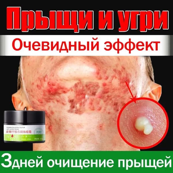Крем для ухода за кожей