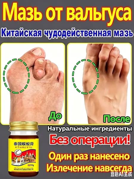 Крем при вальгусной деформации, от шишек на больших пальцах ног, Боль в суставах, подагра20 г