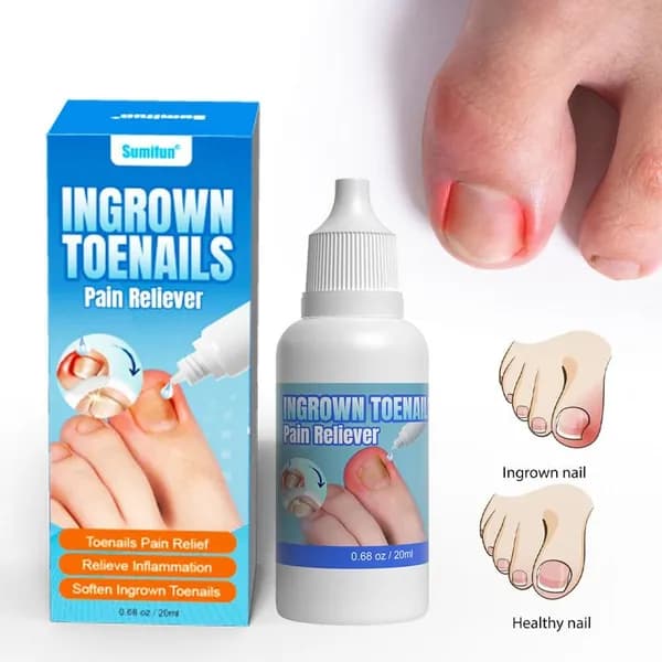 20ML Капли для смягчения ногтей на ногах, подходят для лечения паронихии