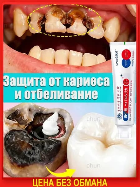 Зубная паста для дырки в зубе, глубокого кариеса и пульпита, Снимает боль, восстанавливает при поражении кариесом у взрослых, Свежее дыхание, 100 г, 1 шт.