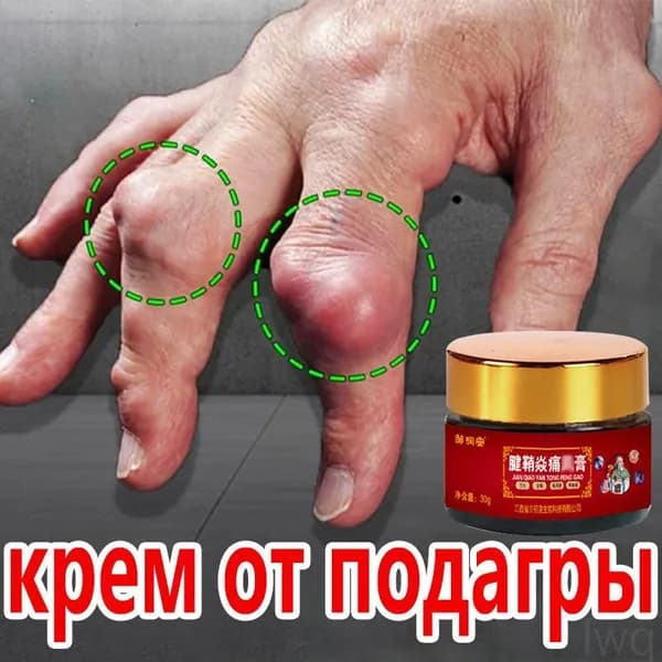 крем от подагры 30 г против покраснения и отеков суставов рук и ног от боли в коленях и ногах снижает уровень мочевой кислоты