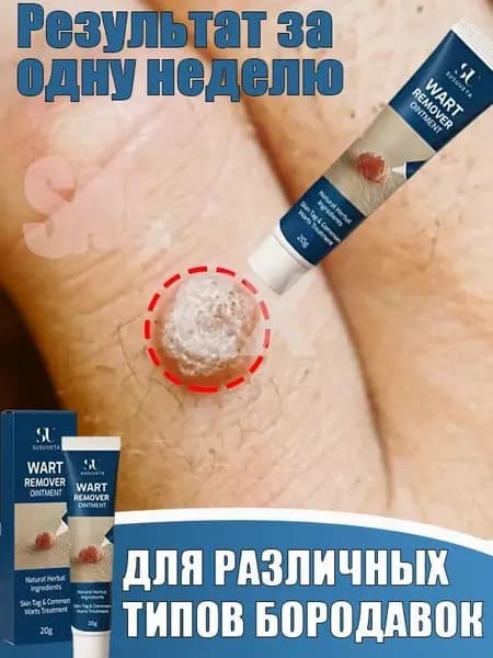 Мазь для лечения бородавок,эффективно удаляет бородавки,папилломы и родинки,подходит для лица и тела,без побочных эффектов,20 г