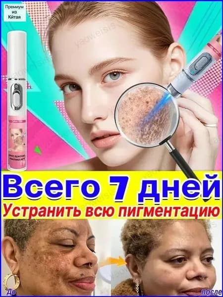 Удаляет пигментные пятна, веснушки, солнечные ожоги, меланодермию, угревую сыпь, морщины.Лазерная указка устраняет пигментацию на лице и теле и отбеливает кожу.1 палочка