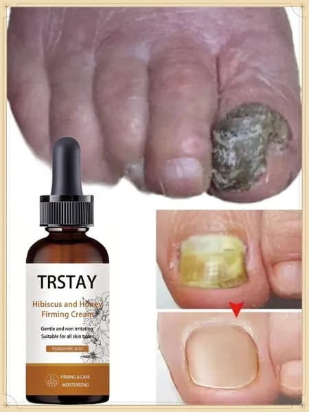 Укрепляющая сыворотка для ногтей TRSTAY с гибискусом и медом, восстанавливает потемневшие и утолщенные ногти, увлажняет кутикулу, устраняет шероховатость пластин