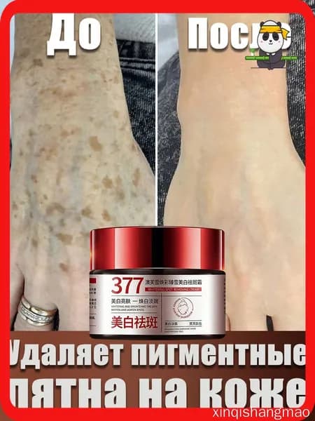 Крем от пигментации для лица 30 г эффективно удаляет веснушки,пигментные пятна солнечные ожоги,старческие пятна,восстанавливает кожу,осветляет тон кожи