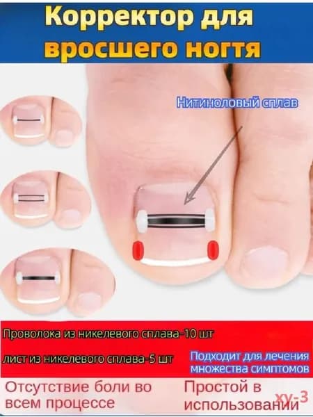 Корректор от вросшего ногтя-T&M
