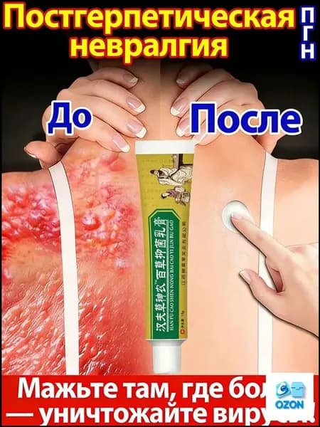 Крем от нейродермита, зуда и покраснений, натуральный, без гормонов