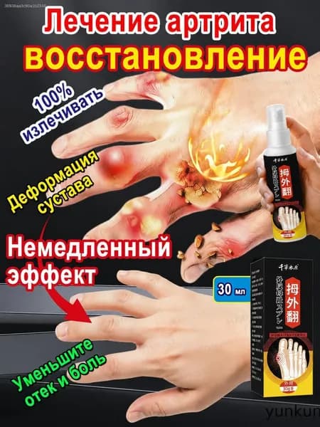 Обезболивающий спрей при артрите,для снятия боли при подагре, артрите, опухших суставах, болях в спине, уменьшает отек и снимает боль,30мл