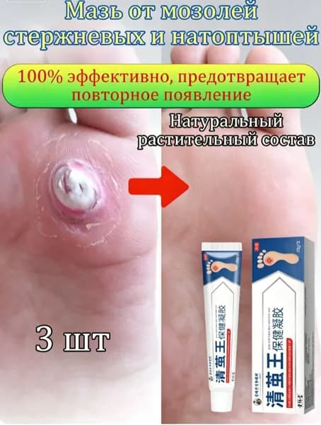 Mазь от мозолей стержневых и натоптышей ,Крем от сухих мозолей, шипицы, бородавок, натоптышей,20 г 1 шт.