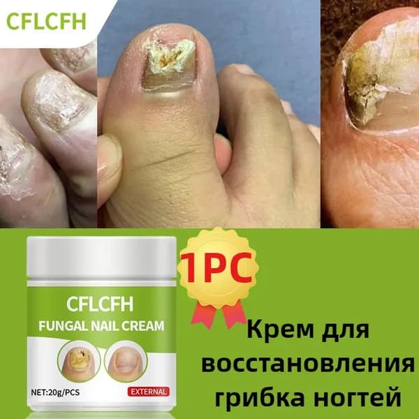 Мазь от грибка ногтей и стопы ног противогрибковая Даошэн. Крем гель от грибка ногтей