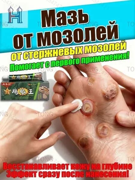 Средство от стержневых мозолей, натоптышей и бородавок