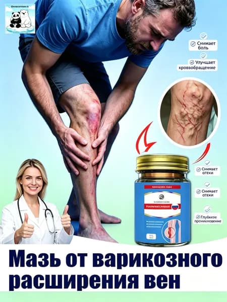 Мазь от варикозного расширения вен ног 50 г мягкое средство для снятия отеков после ходьбы, устраняет тяжесть сосудистую сетку и тромбы