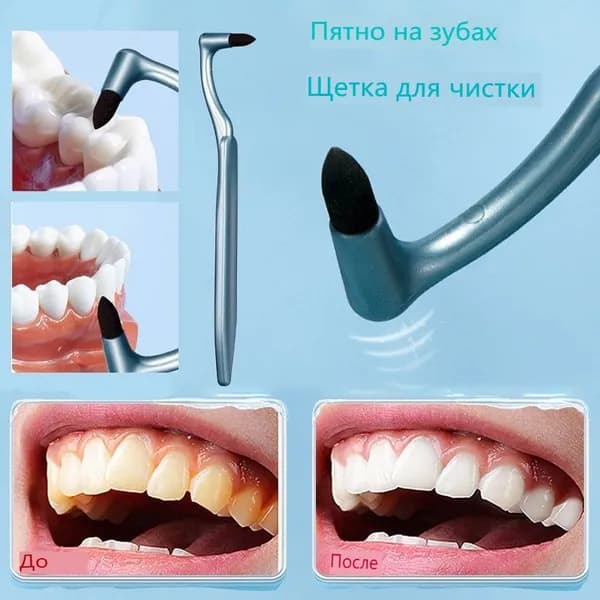 Зубные Щетки, Удаление зубных камней