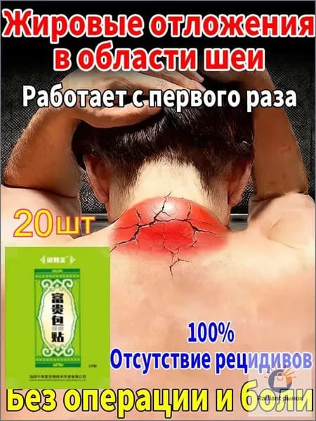 Пластыри от вдовьего горбика - 20 шт: убирают жировой горб на шее