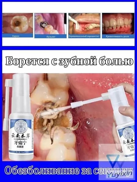 Спрей для лечения зубной боли, при зубной боли, воспалении десен, язвах во рту, снимает боль и отек, 20 мл