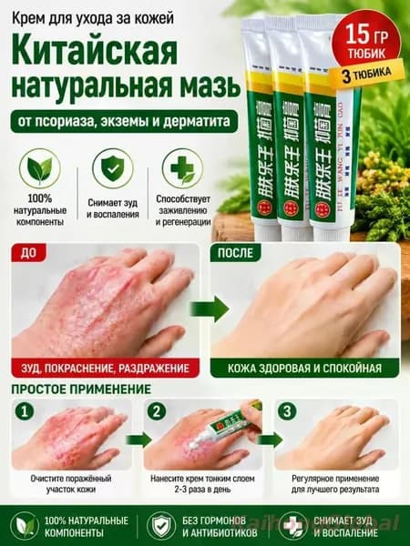 Натуральная китайская мазь от псориаза, экземы и дерматита, быстрое снятие зуда и воспаления, 3 шт