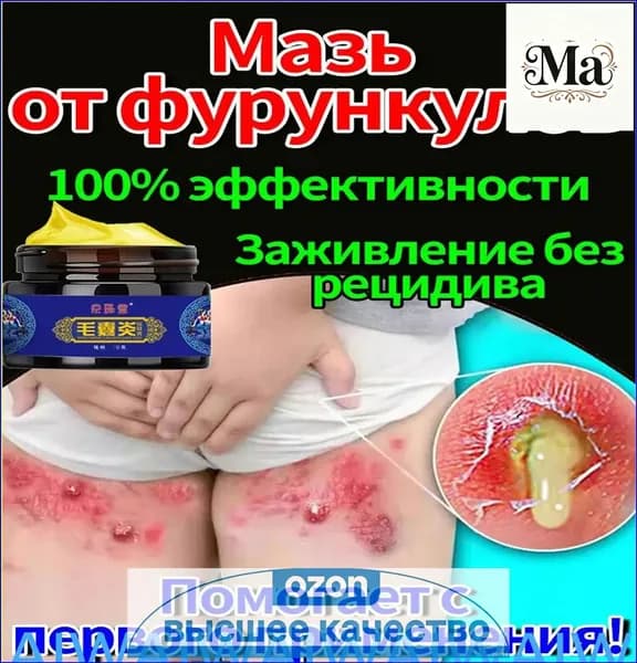 Эксклюзивное средство для прорыва гнойников, вытягивающее гной и снимающее боль, 30 г