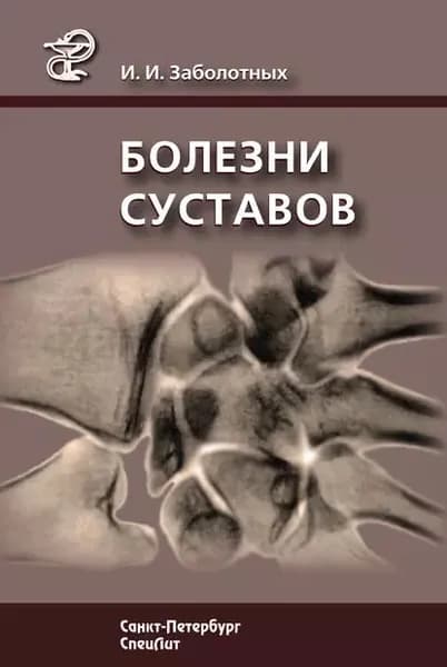 Болезни суставов | Заболотных Инга Ивановна | Электронная книга