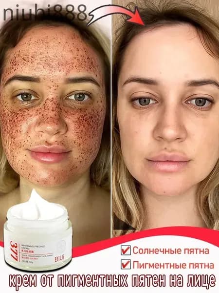 Крем для лица от пигментных пятен и веснушек, осветляющий и выравнивающий тон кожи, 50 г
