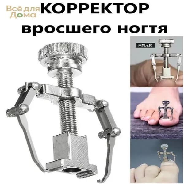 Корректор фиксатор вросшего ногтя