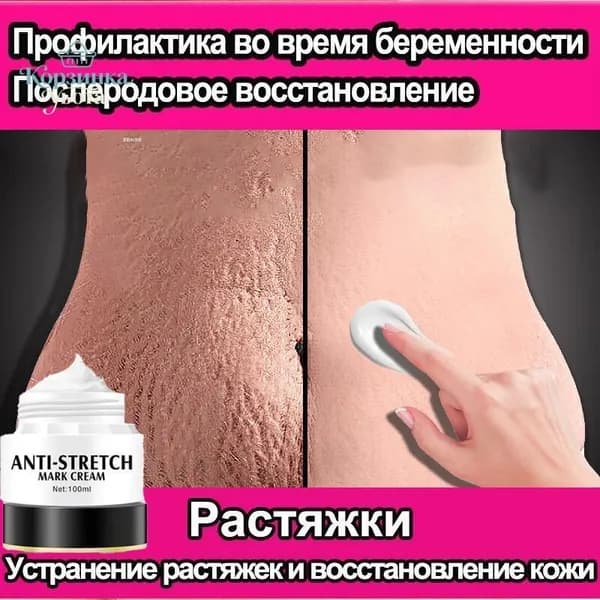 Крем от растяжек уменьшает жировые складки, удаляет растяжки,для тела, для восстановления упругости кожи, питает кожу,100 г