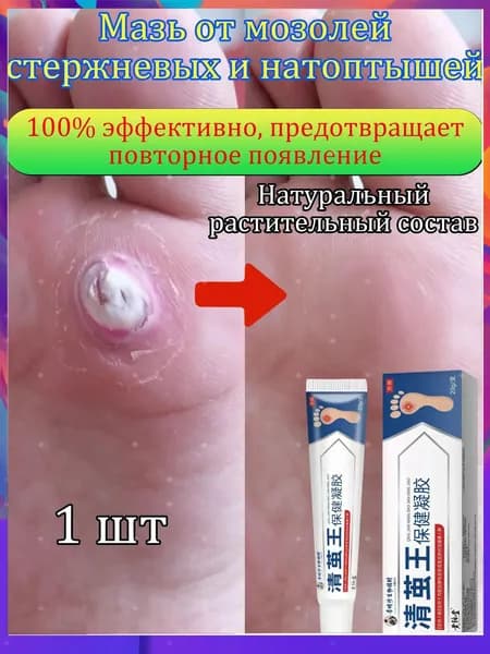 Mазь от мозолей стержневых и натоптышей ,Крем от сухих мозолей, шипицы, бородавок, натоптышей,20 г 1 шт.