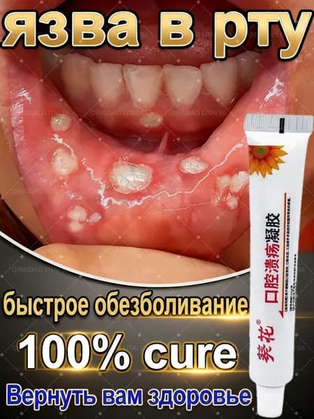 Заживляющий гель для слизистой рта, 10 мл, от стоматита и афт, противовоспалительный, обезболивающий, бактерицидный, восстанавливающий, качественный.