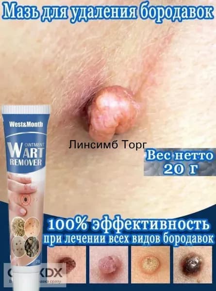 Крем от бородавок и папиллом для удаления мозолей 20 г