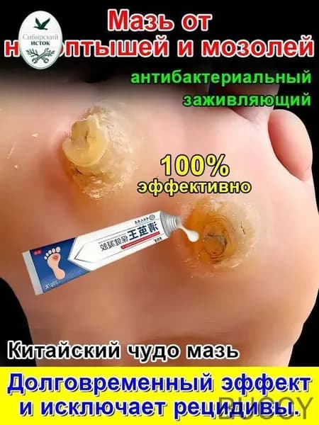 Mазь от мозолей стержневых и натоптышей ,Крем от сухих мозолей, шипицы, бородавок, натоптышей,20 г.