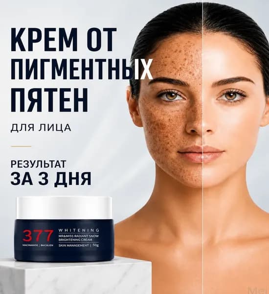 Премиум увлажняющий антивозрастной крем для лица от веснушек и пигментных пятен, 30 г, применяемый для устранения пигментации, восстанавливается жизненная сила кожи.