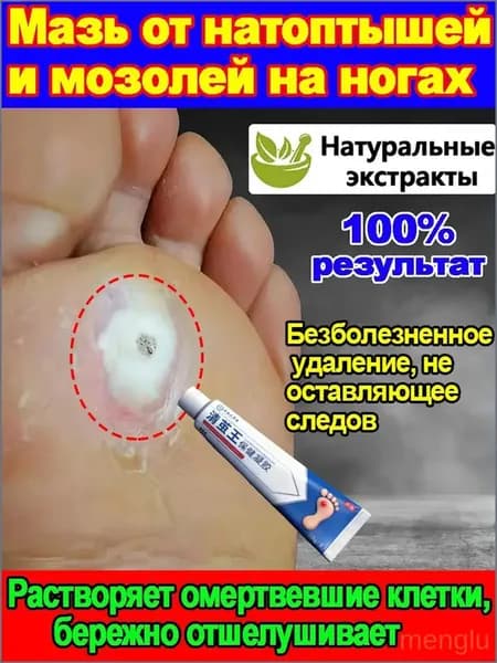 Эксклюзивный крем для устранения сухих натоптышей, стержневых мозолей, шипиц и бородавок, произведённый в Китае, объёмом 20 граммов, признан качественным средством.