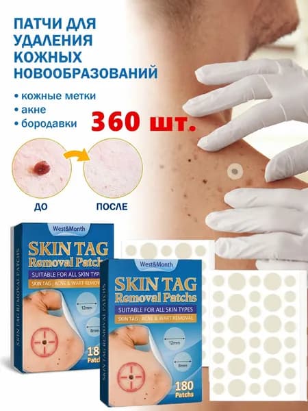 360 шт. Пластырь от папиллом, бородавок, родинок,угревой сыпи