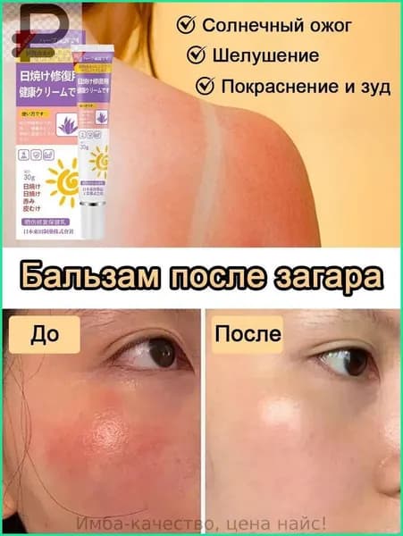 Бальзам после загара, Снимает покраснение шелушение и зуд после солнечных ожогов, Содержит алоэ вера ментол и жимолость, 30 г