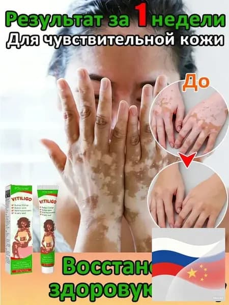 Мазь от витилиго,Средство при нежелательной пигментации витилиго.20 мл