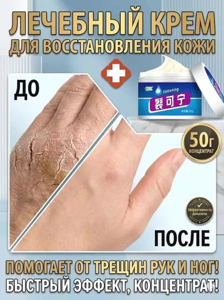 Мазь от трещин на руках и пальцах, крем для заживления кожи, 50г
