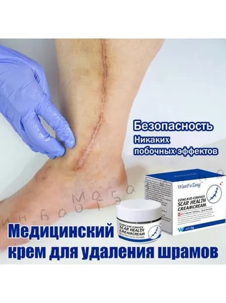Медицинский крем от шрамов 30г, быстрая починка рубцов, от постакне, растяжек для беременных и пигментации, Безопасно, без побочных эффектов, для лица и тела