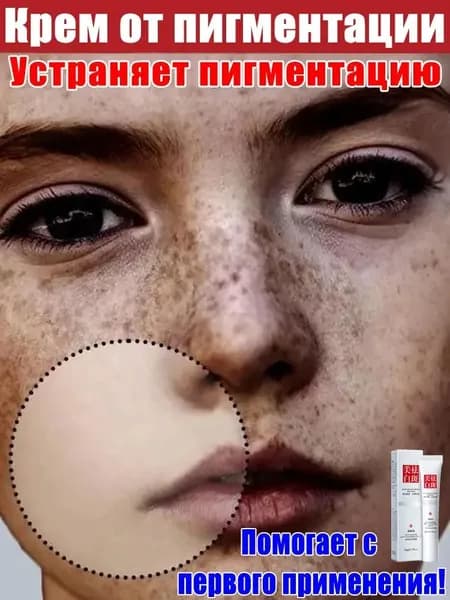 Крем для лица от Веснушек и Пигментных пятен 20г против пигментации,отбеливающий для лица увлажняющий, крем от пигментных пятен на лице,черные точки удаление,китайская чудо-мазь