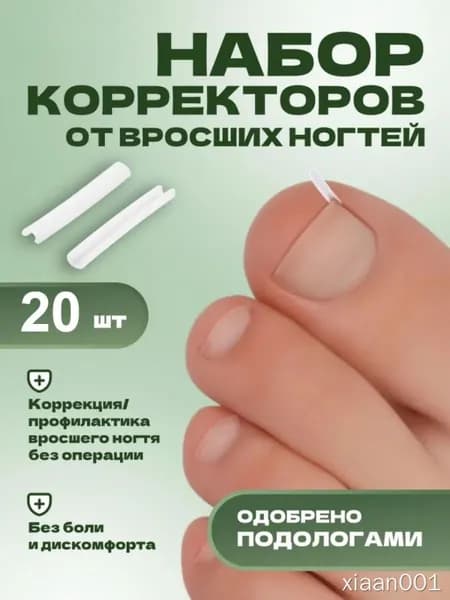 Корректор вросших ногтей