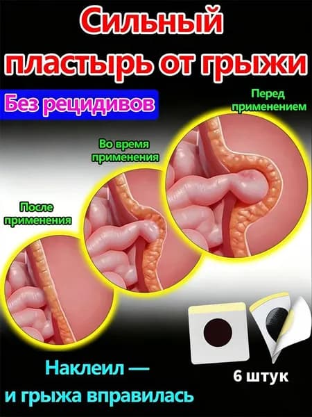 Пластырь (лечебный) от пупочной и паховой грыжи, 6 шт.