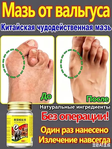 Крем при вальгусной деформации, от шишек на больших пальцах ног, Боль в суставах, подагра20 г