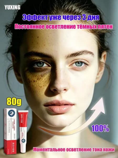 YUXING Крем для осветления веснушек, пигмента и темных кругов под глазами 20г 4 шт